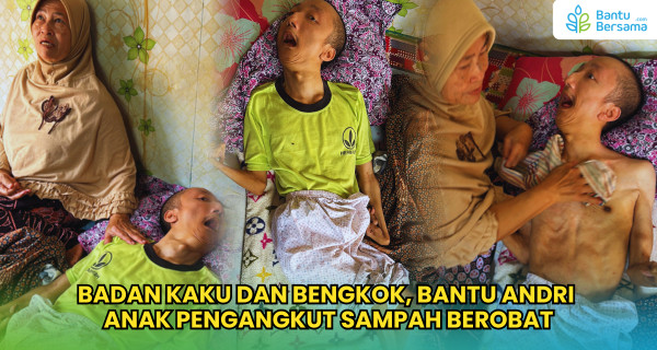 Badan Kaku Dan Bengkok, Bantu Andri Anak Pengangkut Sampah Berobat